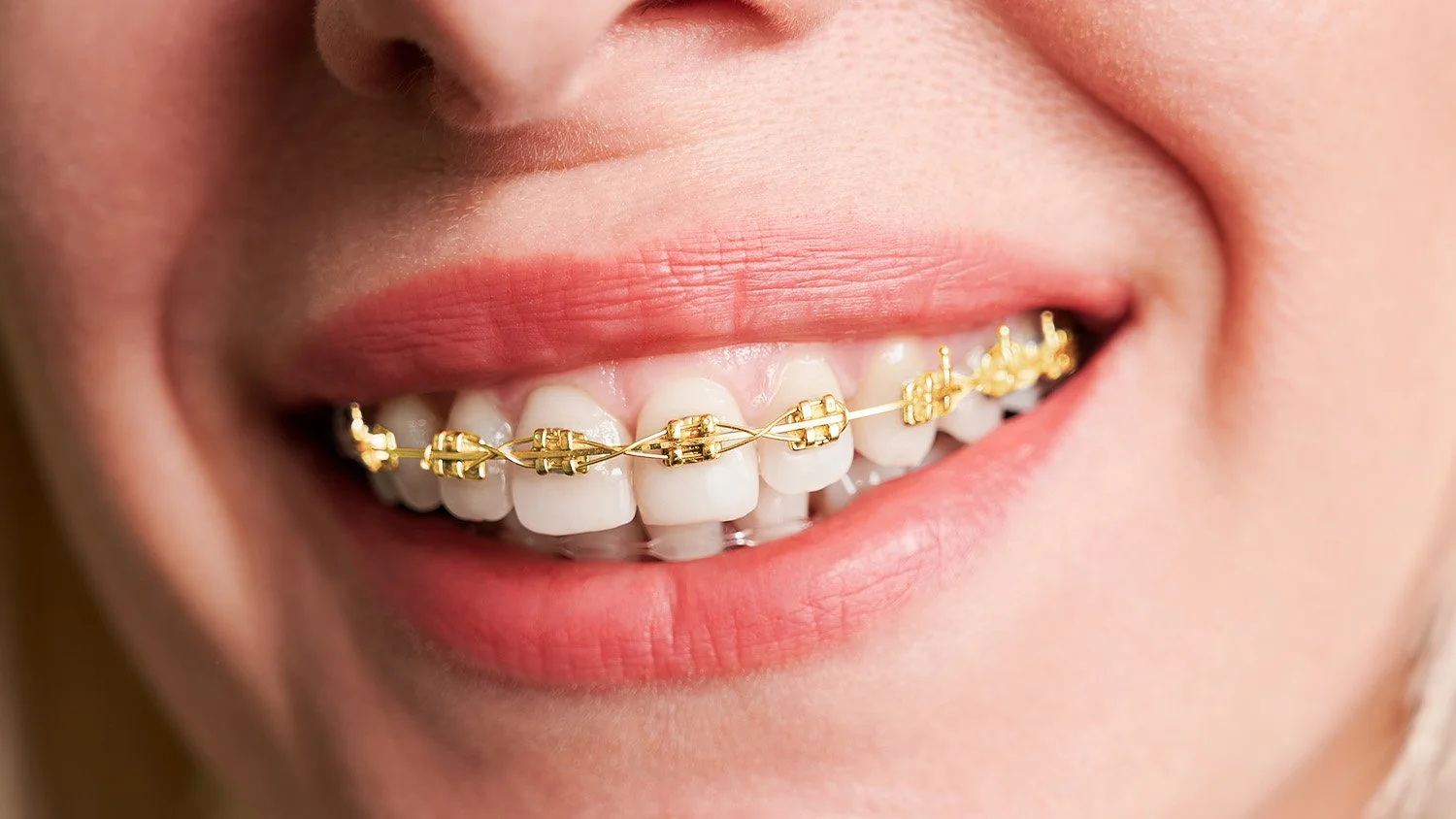 bigstock-Close-Up-Of-Smiling-Patient-Sh-407669021+gold